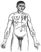 Criminale col corpo tatuato. Da Lombroso,1876